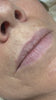 Lippen Permanent Make-up vorher/nachher – BelViso Cosmetics