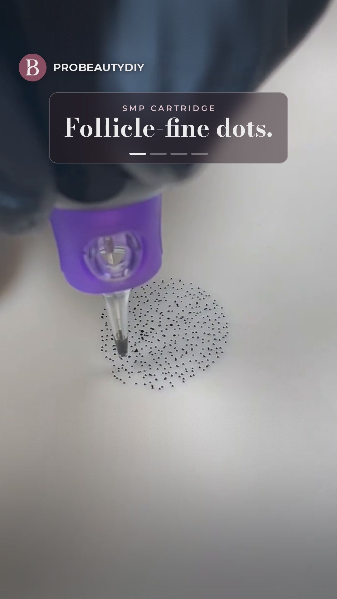 IRIS SMP cartridge demo: dot placement and density on practice skin